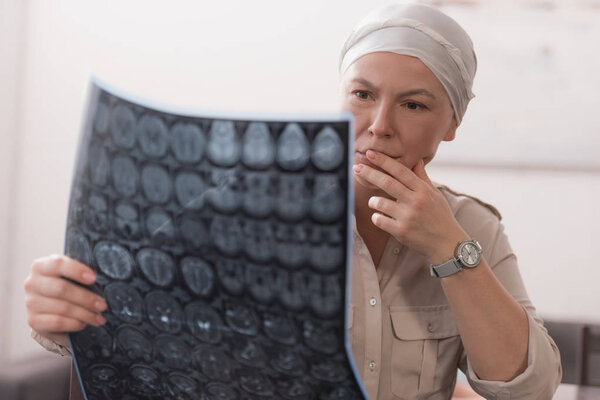 serious sick mature woman in kerchief holding mri scan 