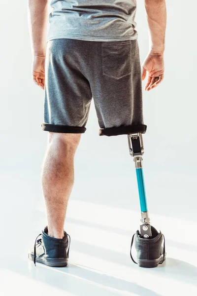 Uomo con protesi alle gambe — Foto stock