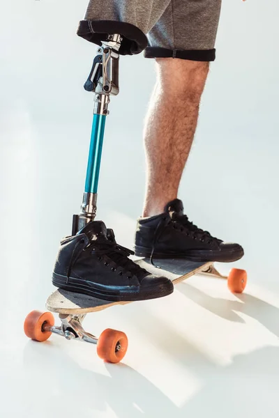 Uomo con protesi alle gambe in piedi su skateboard — Foto stock
