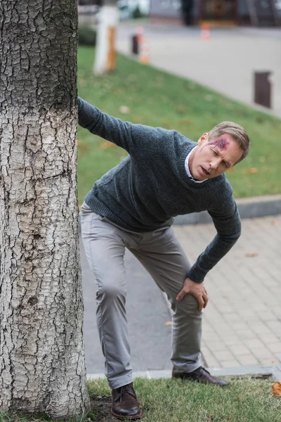 Injured middle aged man with wound on head leaning on tree on the street — Stock Photo