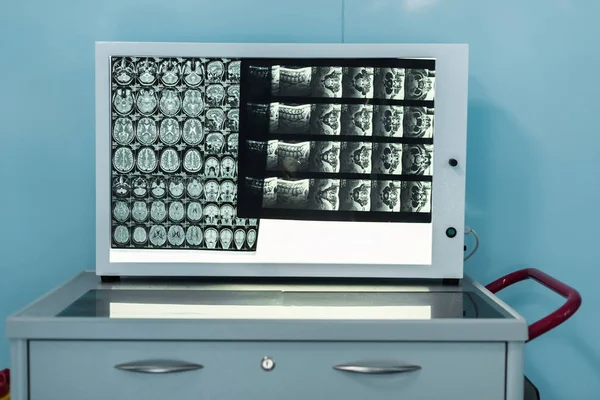 Pantalla médica con rayos X en el hospital moderno - foto de stock