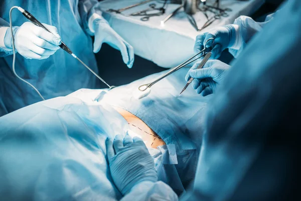 Imagem recortada de cirurgiões operando paciente em sala de cirurgia — Fotografia de Stock