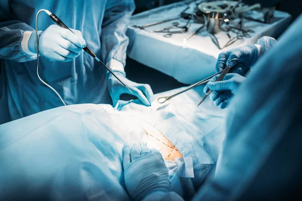 Обрезанное изображение хирургов, оперирующих пациента в операционной — стоковое фото