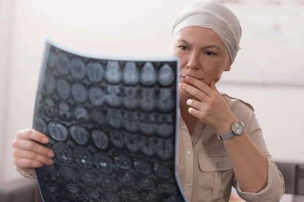 Grave enfermo maduro mujer en kerchief holding mri scan - foto de stock