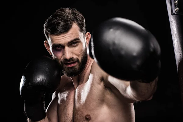 Boxer with black eye — Stock Photo, Image