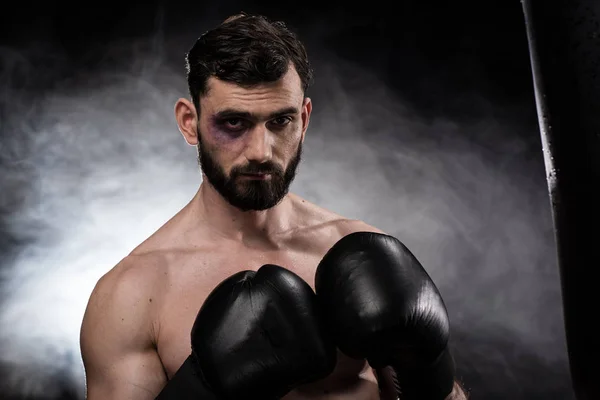 Boxer with black eye — Stock Photo, Image