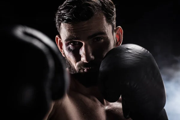 Jovem boxeador em luvas — Fotografia de Stock