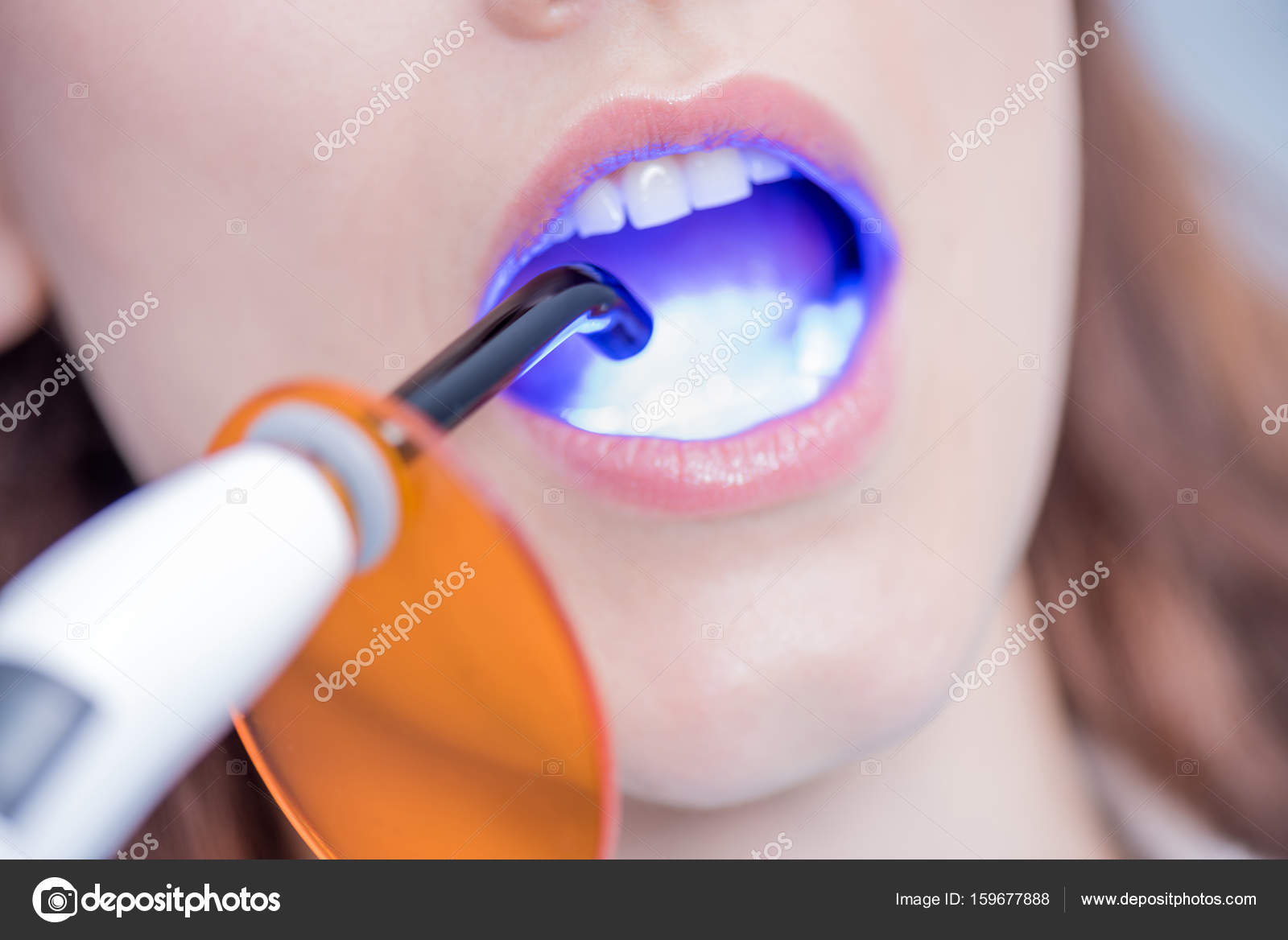 Patient and dental curing light — Stock Photo © DmitryPoch 159677888