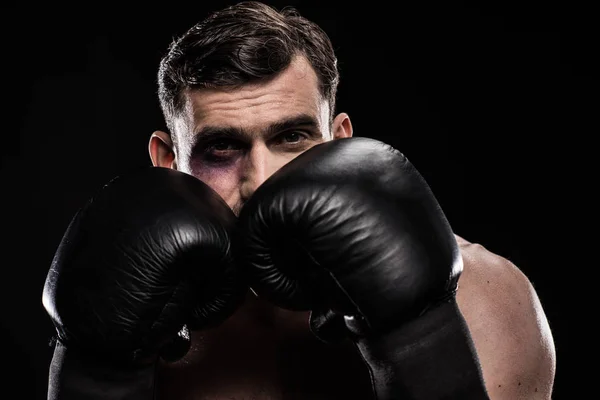 Boxeador con ojo negro - foto de stock