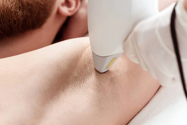 Homme recevant des soins laser de la peau — Photo de stock