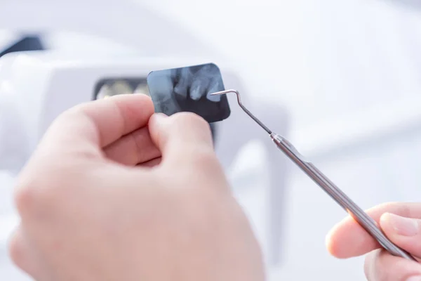 Dentista apuntando a la imagen de rayos X - foto de stock