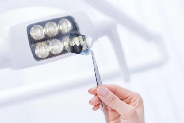 Dentist holding xray picture — Stock Photo