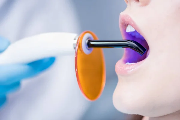 Patient and dental curing light — Stock Photo