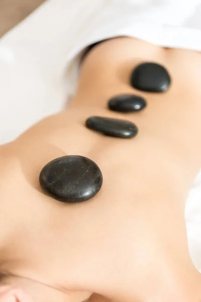 Mujer teniendo terapia de piedra - foto de stock