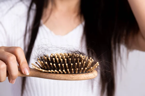 Healthy Concept Woman Show Her Brush Damaged Long Loss Hair — Stock Photo, Image