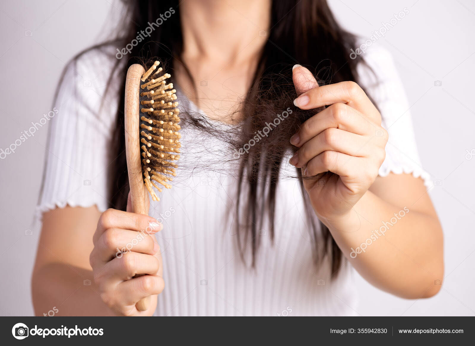 hairloss