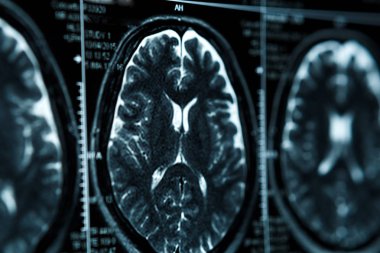 MRI ya da manyetik rezonans görüntüsü baş ve beyin taraması. Görünümü kapatın