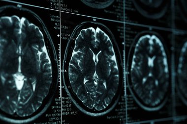 MRI ya da manyetik rezonans görüntüsü baş ve beyin taraması. Görünümü kapatın