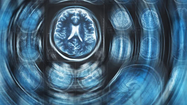 Mri brain scan background, tomography, with blur circle motion effect