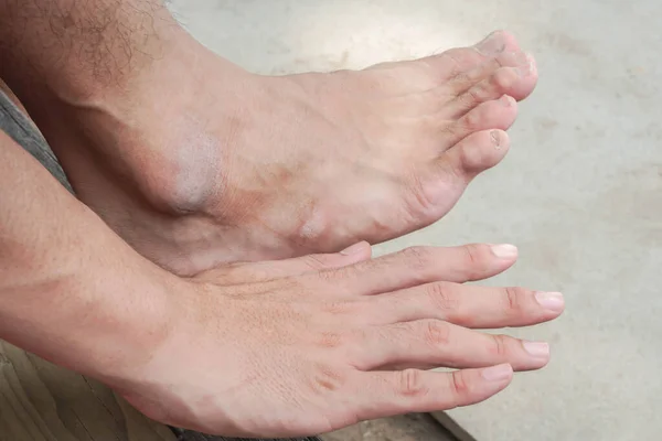 Κλείστε Καθαρό Άνδρες Δεξιά Πόδι Και Χέρι — Φωτογραφία Αρχείου