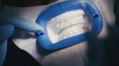 Güzel kız diş beyazlatma