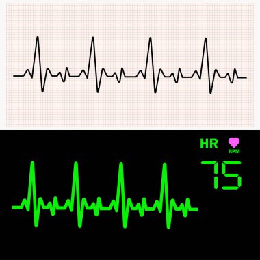 Kalp kardiyogram dalgalar grafik kağıdı ve monitör. Vektör çizim.