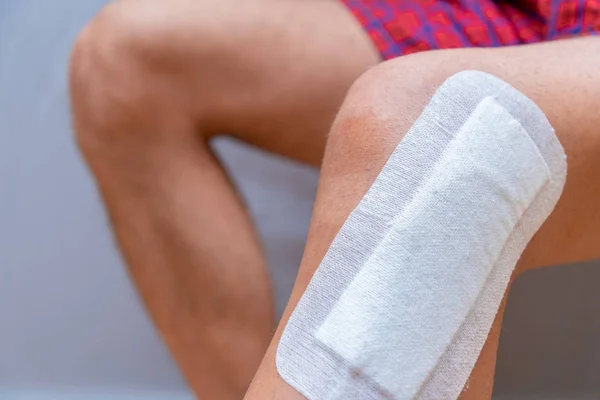 Tıbbi Alçı Ameliyattan Sonra Erkek Bacağına Yapışmış — Stok fotoğraf