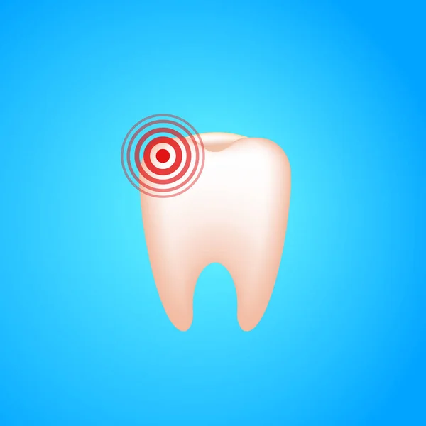 Kiespijn. Een tand met cariës en pijn — Stockvector