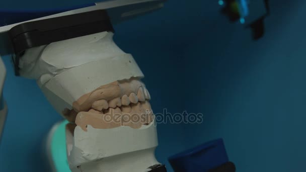Le dentiste fabrique un modèle 3D pour prothèse sculptée — Video