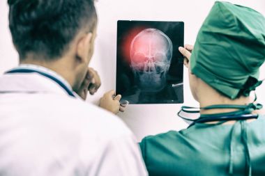 Doktorlar hastanın başına röntgen filmine bakarken
