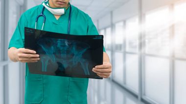 Cerrahi doktor röntgen filmine bakarken.
