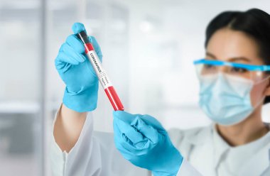 Coronavirus COVID 19 tıbbi test aşısı araştırma ve geliştirme konsepti. COVID-19 için ilaç tedavisi üretmek üzere Coronavirus antikor bilimsel örneklerini inceleyen ve analiz eden bilim insanları.